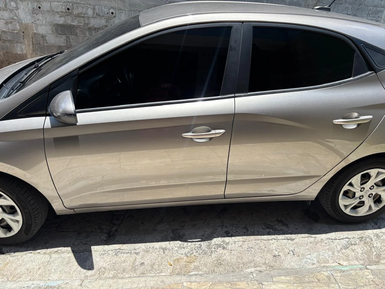 HYUNDAI HB20 10M VISION